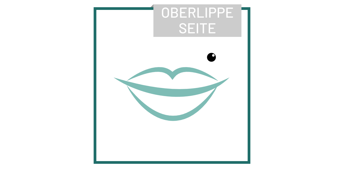 piercing_OberlippeSeite