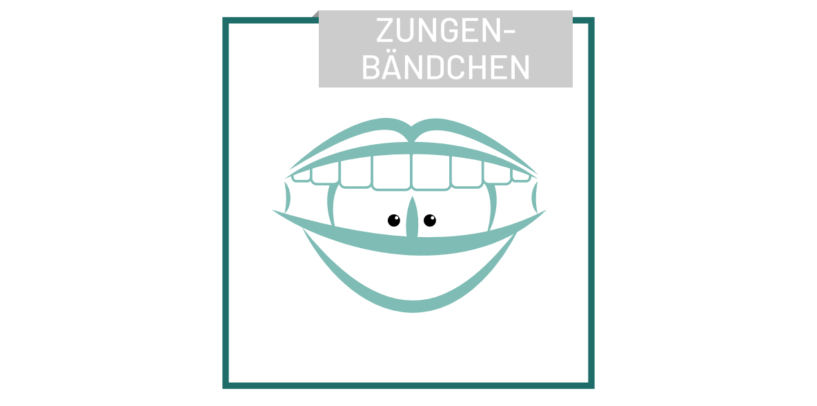 piercing_Zungenbaendchen